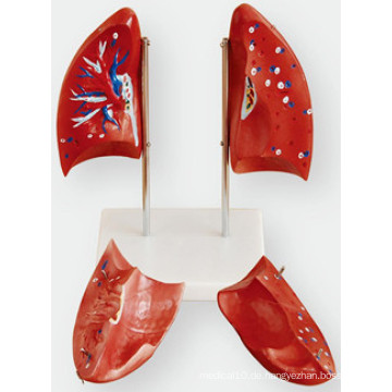 Anatomische Lungen-Simulation Modell Weichengya